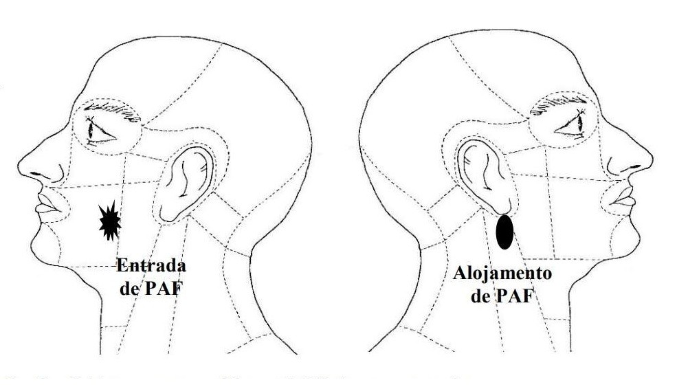 Laudo reforça versão da família sobre jovem morto pela PM